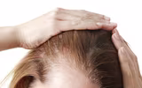 [ẢNH] Cảnh giác trước những hiểm họa từ thói quen để tóc ướt đi ngủ