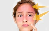 [ẢNH] Những quan niệm sai lầm nhiều người mắc phải khi sử dụng kem chống nắng