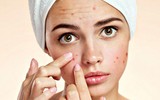 [ẢNH] Những quan niệm sai lầm nhiều người mắc phải khi sử dụng kem chống nắng