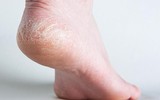 [ẢNH] Công dụng tuyệt vời của những loại vỏ tưởng chừng bỏ đi