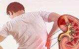 [ẢNH] Những dấu hiệu cảnh báo sớm bệnh sỏi thận bạn nên biết