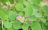 [ẢNH] Những dấu hiệu cảnh báo sớm bệnh sỏi thận bạn nên biết