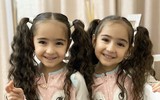 [ẢNH] Giải mã sức hút của những cặp song sinh được mệnh danh đẹp nhất thế giới