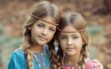 [ẢNH] Giải mã sức hút của những cặp song sinh được mệnh danh đẹp nhất thế giới