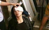 [ẢNH] Những tai nạn bất ngờ trên phim trường khiến nhiều diễn viên 