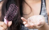 [ẢNH] Những thói quen gây rụng tóc dễ mắc phải