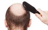 [ẢNH] Những thói quen gây rụng tóc dễ mắc phải