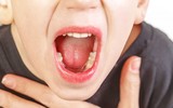 [ẢNH] Tác hại khôn lường khi uống nước đá lạnh thường xuyên