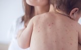 [ẢNH] Những sai lầm khi ăn thịt gà nhiều người mắc phải