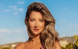[ẢNH] Nữ hoàng sắc đẹp Daniella Álvarez và tinh thần lạc quan dù phải cưa chân