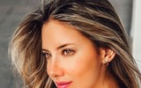 [ẢNH] Nữ hoàng sắc đẹp Daniella Álvarez và tinh thần lạc quan dù phải cưa chân