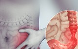 [ẢNH] Cảnh báo những loại gia vị có thể gây nguy hiểm đến sức khỏe cần tránh