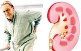 [ẢNH] Cảnh báo những loại gia vị có thể gây nguy hiểm đến sức khỏe cần tránh