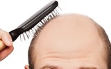[ẢNH] Những đặc điểm của cha mẹ dễ di truyền cho con cái