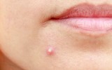 [ẢNH] Những đặc điểm của cha mẹ dễ di truyền cho con cái