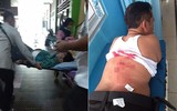 [Ảnh] Toàn cảnh vụ Bộ trưởng An ninh Indonesia bị nghi phạm theo IS tấn công bằng dao