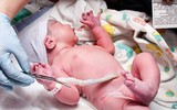 Thế giới năm 2019 có gì để con người ta lạc quan hơn?