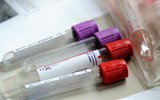 Nếu xảy ra đại dịch, thế giới có thể mất đi 33 triệu người chỉ trong 6 tháng