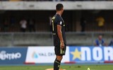 [ẢNH] Vừa đến Serie A, Ronaldo đã làm đối thủ gãy mũi và nhập viện