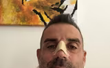 [ẢNH] Vừa đến Serie A, Ronaldo đã làm đối thủ gãy mũi và nhập viện