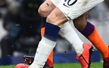 [ẢNH] Bị đạp thô bạo thế này, Harry Kane thoát gãy chân là may!