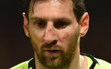 [ẢNH] Sốc với hình ảnh Messi mặt mũi bầm dập sau khi lĩnh đòn của Smalling