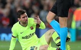 [ẢNH] Sốc với hình ảnh Messi mặt mũi bầm dập sau khi lĩnh đòn của Smalling