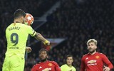 [ẢNH] Sốc với hình ảnh Messi mặt mũi bầm dập sau khi lĩnh đòn của Smalling
