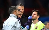 [ẢNH] Sốc với hình ảnh Messi mặt mũi bầm dập sau khi lĩnh đòn của Smalling