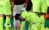 [ẢNH] Sốc với hình ảnh Messi mặt mũi bầm dập sau khi lĩnh đòn của Smalling