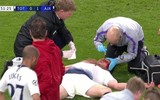[ẢNH] Rợn người hình ảnh sao Tottenham nằm sân với khuôn mặt đầm đìa máu