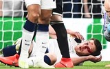 [ẢNH] Rợn người hình ảnh sao Tottenham nằm sân với khuôn mặt đầm đìa máu