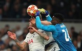 [ẢNH] Rợn người hình ảnh sao Tottenham nằm sân với khuôn mặt đầm đìa máu