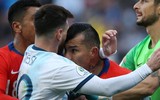 [ẢNH] Cận cảnh tình huống Messi bị gây gổ, nhận thẻ đỏ oan uổng
