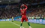 [ẢNH] Quang Hải bị 