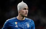 [ẢNH] Trung vệ đắt giá đổ máu vẫn không cứu nổi Juve