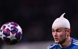 [ẢNH] Trung vệ đắt giá đổ máu vẫn không cứu nổi Juve
