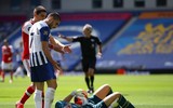 [ẢNH] Đau đớn nằm cáng, thủ môn Arsenal vẫn bật dậy chỉ thẳng mặt 