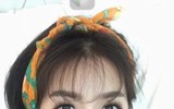 Cuoc song cua Que Van sau phau thuat tham my hoa ra la nhu the nay! - Anh 2