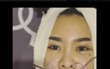 Cuoc song cua Que Van sau phau thuat tham my hoa ra la nhu the nay! - Anh 1