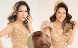 1 tháng sau vụ bỏng, Hồng Ngọc xuất hiện với hình ảnh không thể tin nổi