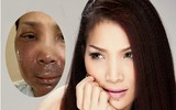 1 tháng sau vụ bỏng, Hồng Ngọc xuất hiện với hình ảnh không thể tin nổi