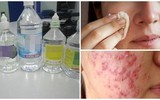 [Ảnh] Nhận diện những dấu hiệu tổn thương do kiến ba khoang và cách xử lý 