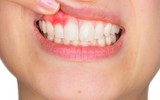 [ẢNH] Những tác dụng tuyệt vời của trà khi sử dụng đúng cách