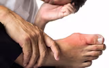 [ẢNH] Những thực phẩm 'nhất định phải ăn' khi mắc bệnh gout