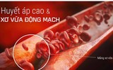 [Ảnh] Lợi ích không ngờ tới của việc ngủ sớm, ngủ đủ giấc