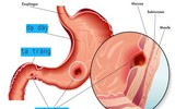 [ẢNH] Những hiểm hoạ ‘không ngờ tới’ của việc ngủ muộn đối với sức khoẻ