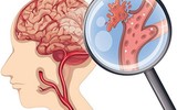 [ẢNH] Những hiểm hoạ ‘không ngờ tới’ của việc ngủ muộn đối với sức khoẻ