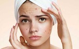 [ẢNH] Những hiểm hoạ ‘không ngờ tới’ của việc ngủ muộn đối với sức khoẻ