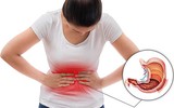 [Ảnh] Tác dụng đáng kinh ngạc của kim chi với sức khỏe con người